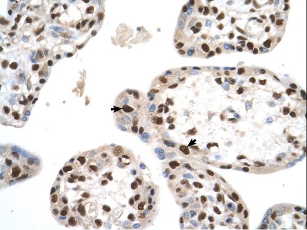 SETD2 Antibody (aa323-372)