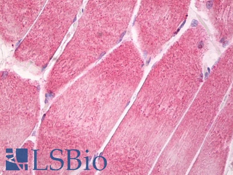 Polyclonal Rabbit anti-Human CNTFR Antibody (aa295-344, IHC, WB)