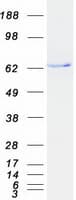 Human CACNB1 Protein (Recombinant Myc-DDK (Flag))