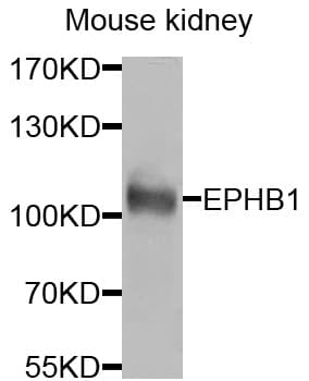 EPHB1 / EPH Receptor B1 Antibody