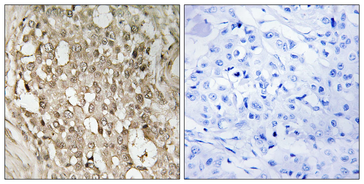 Polyclonal Rabbit anti-Human RELA / NFKB p65 Antibody (phospho-Ser529, IHC, WB)