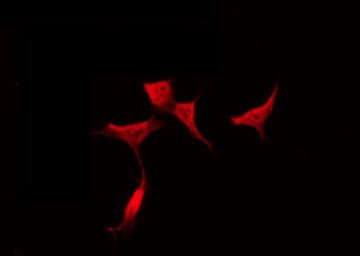 PPP1R14D / CPI17-Like Antibody