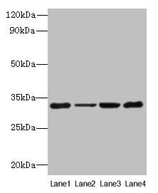 Polyclonal Rabbit anti-Human PDCD1 / CD279 / PD-1 Antibody (IHC, WB)