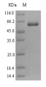 Human PRR11 Protein (Recombinant 6His-SUMO, N-terminus)
