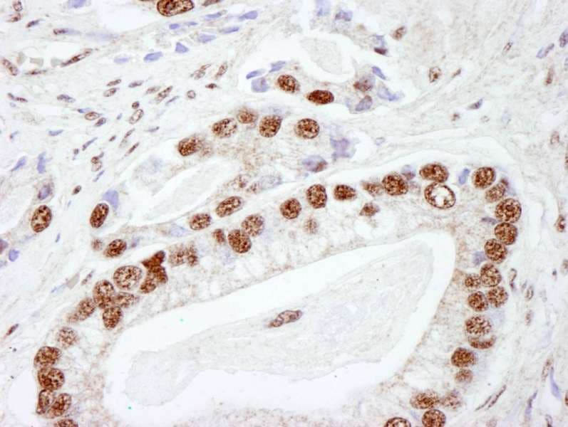 PRKDC / DNA-PKcs Antibody (aa2100-2150)
