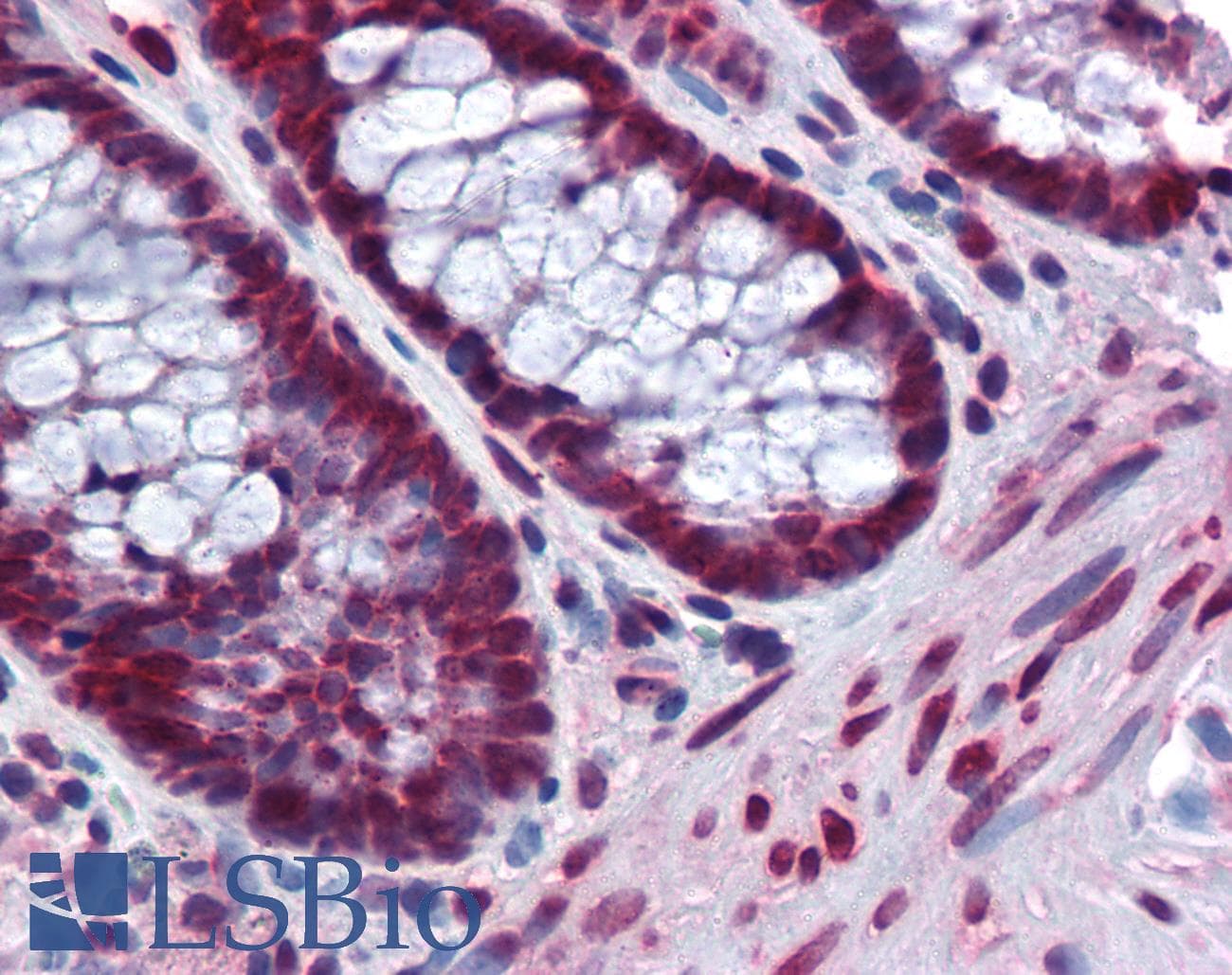 IHC-plus™ BANF1 / BAF / BCRP1 Antibody (clone 3F10-4G12)