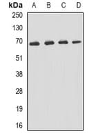 Polyclonal Rabbit anti-Human SQSTM1 Antibody (IHC, WB)