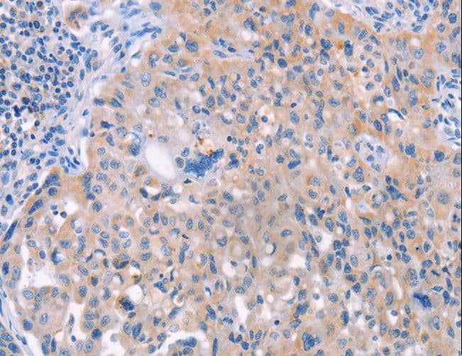 AP1B1 / BAM22 Antibody