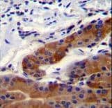 Polyclonal Rabbit anti-Human WHRN Antibody (aa378-406, IHC, WB)