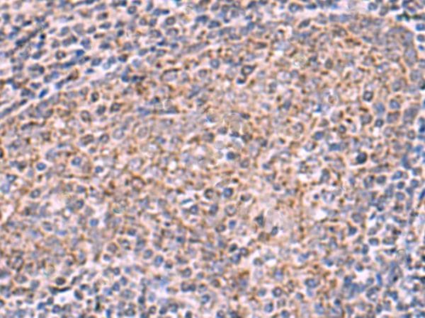 Polyclonal Rabbit anti-Human ECSIT Antibody (IHC)