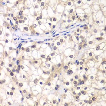 USF1 / USF Antibody