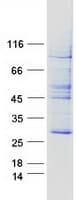Human DERL2 / Derlin-2 Protein (Recombinant Myc-DDK (Flag))