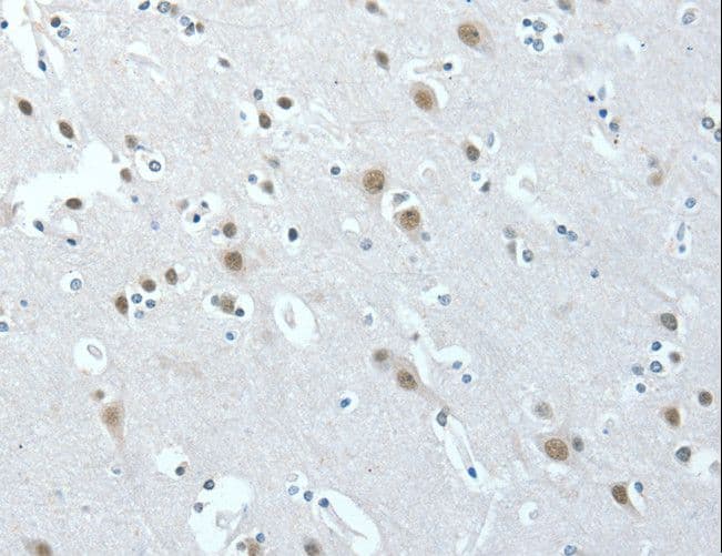 ACLY / ATP Citrate Lyase Antibody