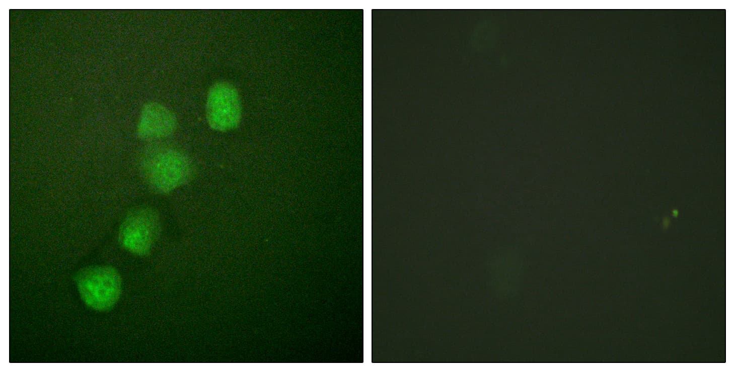 PathPlus™ CCNE1 / Cyclin E1 Antibody (aa361-410)