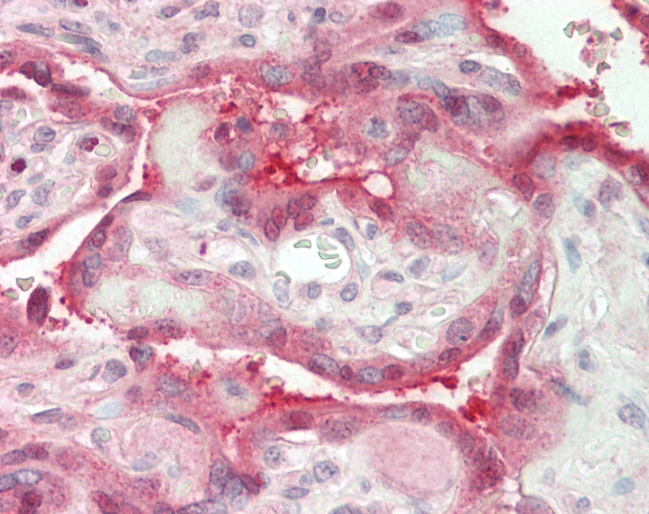 Polyclonal Rabbit anti-Human SERPINE1 / PAI-1 Antibody (aa201-250, IHC, WB)
