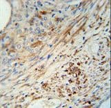 Polyclonal Rabbit anti-Human KIF9 Antibody (aa581-609, IHC, WB)