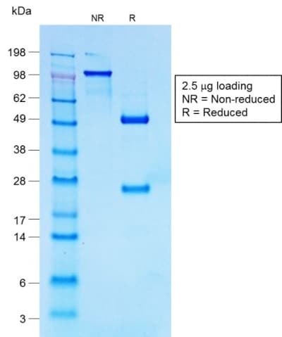 Recombinant Monoclonal Rabbit anti-Human CD30 Antibody (clone Ki-1/1747R, Azide-free,Carrier-free, IHC)