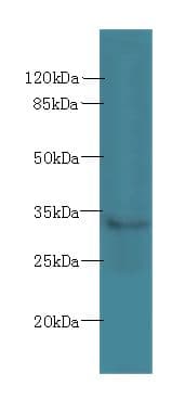Polyclonal Rabbit anti-Human SLC25A51 / MCART1 Antibody (WB)