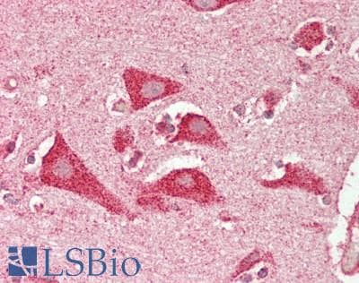 IHC-plus™ Polyclonal Rabbit anti-Human PSEN2 / Presenilin 2 Antibody (aa275-325, IHC, WB)