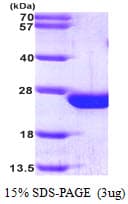 Human RAC2 Protein (Recombinant His)