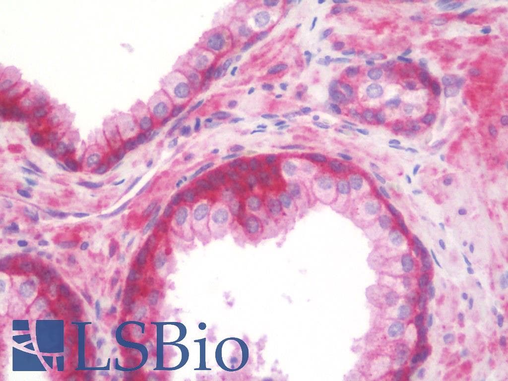 IHC-plus™ Polyclonal Rabbit anti-Human TPT1 / TCTP Antibody (IHC, IF, WB)