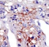 PIP5K1C Antibody (aa26-57)