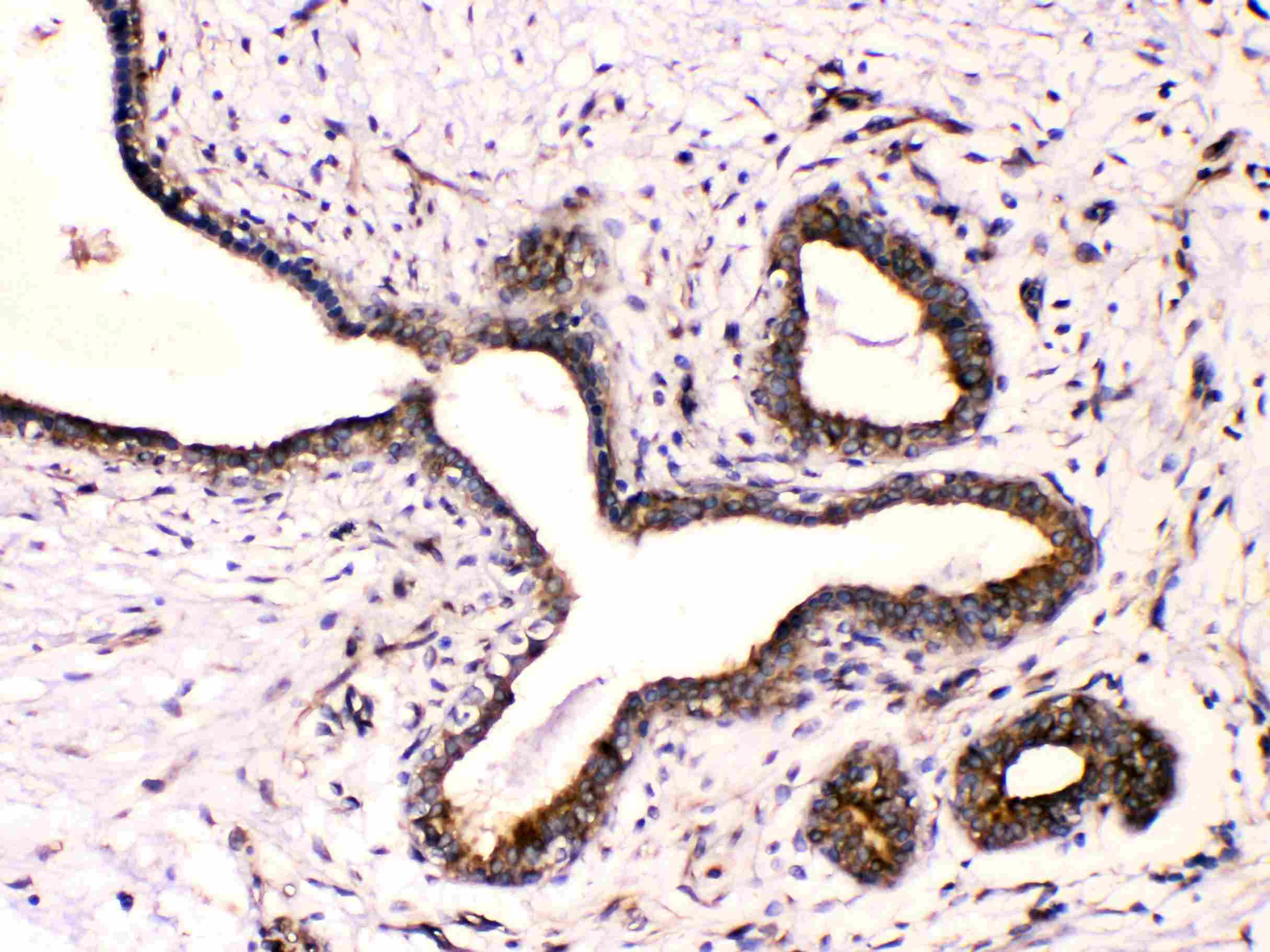 Polyclonal Rabbit anti-Human TUBB / Beta Tubulin Antibody (IHC, WB)