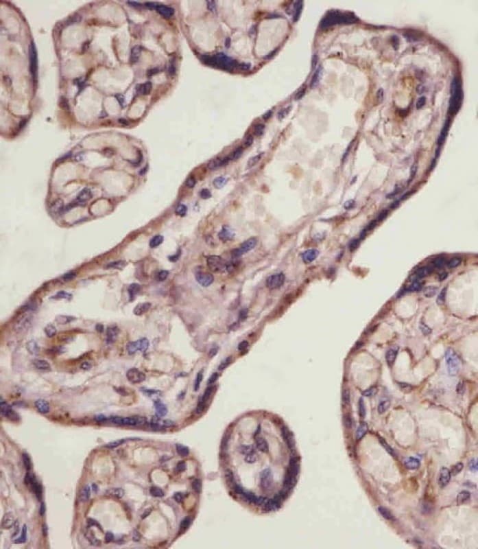 Betaglycan / TGFBR3 Antibody (N-Terminus)