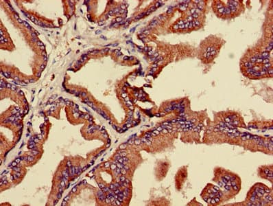 Polyclonal Rabbit anti-Human MAPK3 / ERK1 Antibody (IHC, WB)