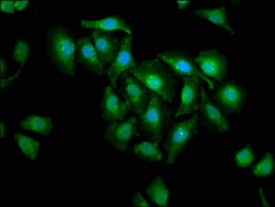 IHC-plus™ Polyclonal Rabbit anti-Human CASP3 / Caspase 3 Antibody (aa 29-175, IHC, WB)