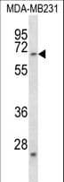 FZD2 / Frizzled 2 Antibody (aa534-563)
