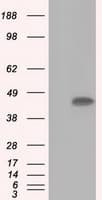ACAT2 Antibody (clone OTI3E2)