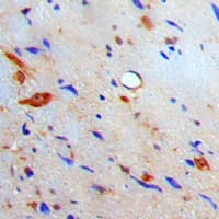 Polyclonal Rabbit anti-Human S100A10 Antibody (Internal, IHC, WB)