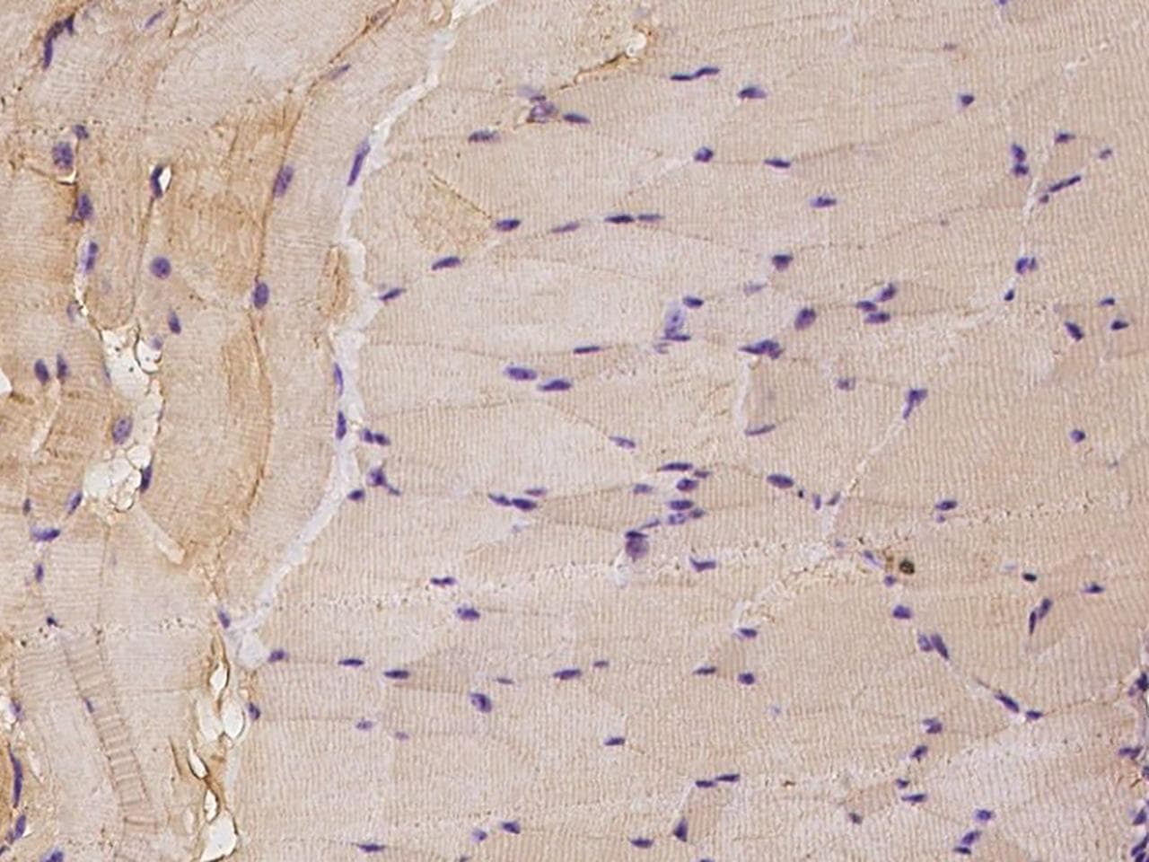RAF1 / RAF Antibody