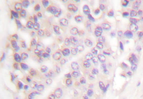 Polyclonal Rabbit anti-Human SMAD3 Antibody (Pro417, IHC, WB)