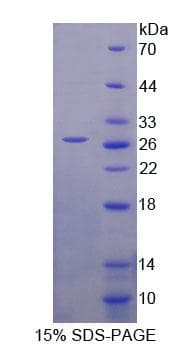 Human HSPA12B Protein (Recombinant His-T7)