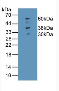 SLC40A1 / Ferroportin-1 Antibody