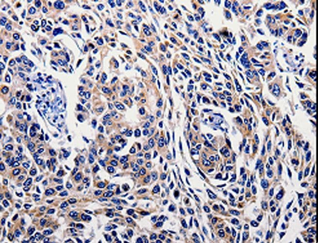 IL10RB Antibody