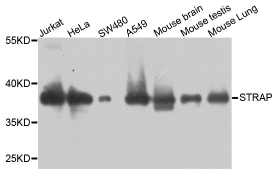 STRAP / MAWD Antibody
