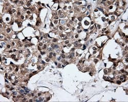 ELAVL1 / HUR Antibody (clone OTI14F4)