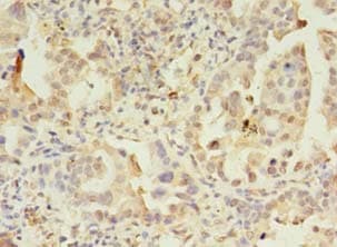 Polyclonal Rabbit anti-Human APAF1 / APAF-1 Antibody (IHC)