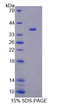 Human XRN1 Protein (Recombinant)