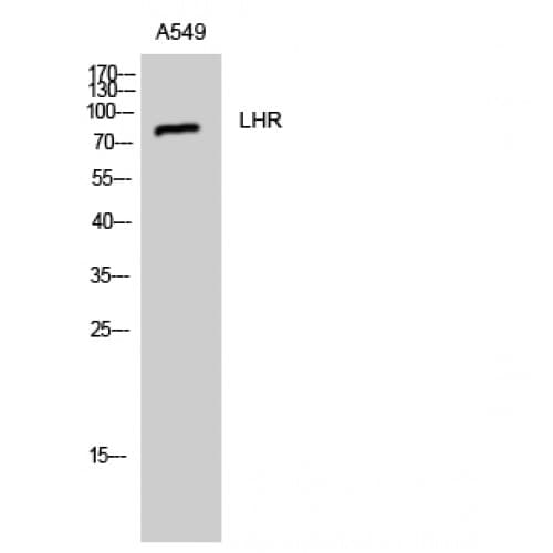 Polyclonal Rabbit anti-Human LHCGR / LHR / LH Receptor Antibody (590-670 aa, C-terminal, IF, WB)