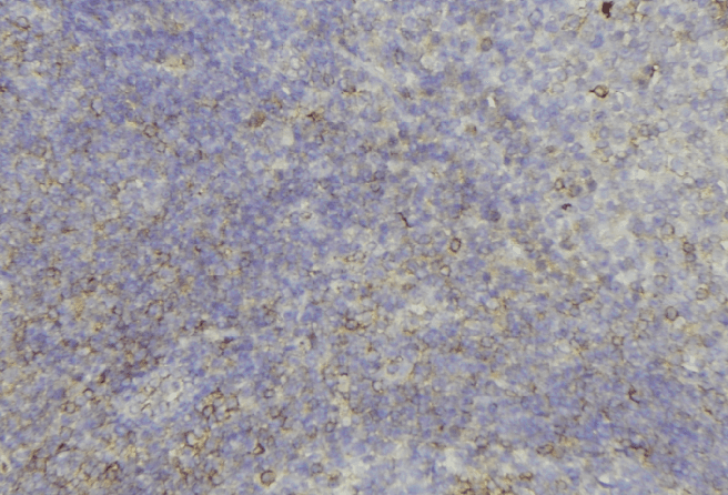 KRT6C / CK6C / Cytokeratin 6C Antibody