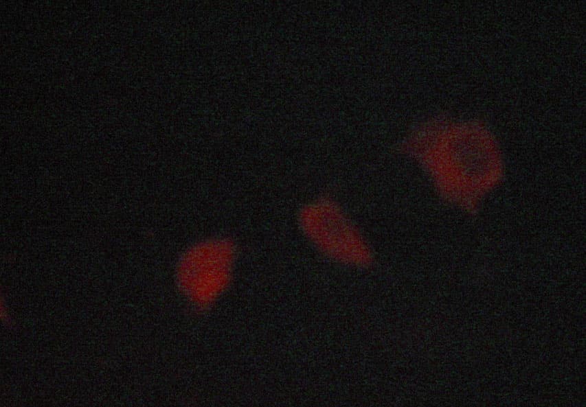 Polyclonal Rabbit anti-Human SYK Antibody (phospho-Tyr323, IHC, IF, WB)