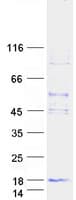 Human DAP12 Protein (Recombinant Myc-DDK (Flag))
