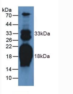 NT-proANP Antibody