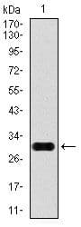 Monoclonal Mouse anti-Human GPC3 / Glypican 3 Antibody (clone 9C2, IHC, IF, WB)