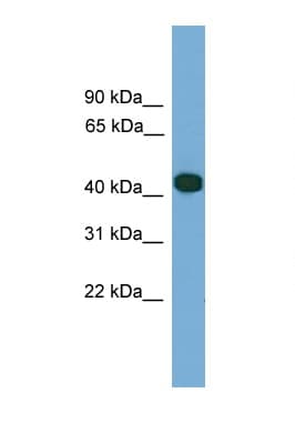 Polyclonal Rabbit anti-Human SERPINI2 / PANCPIN Antibody (aa323-372, WB)