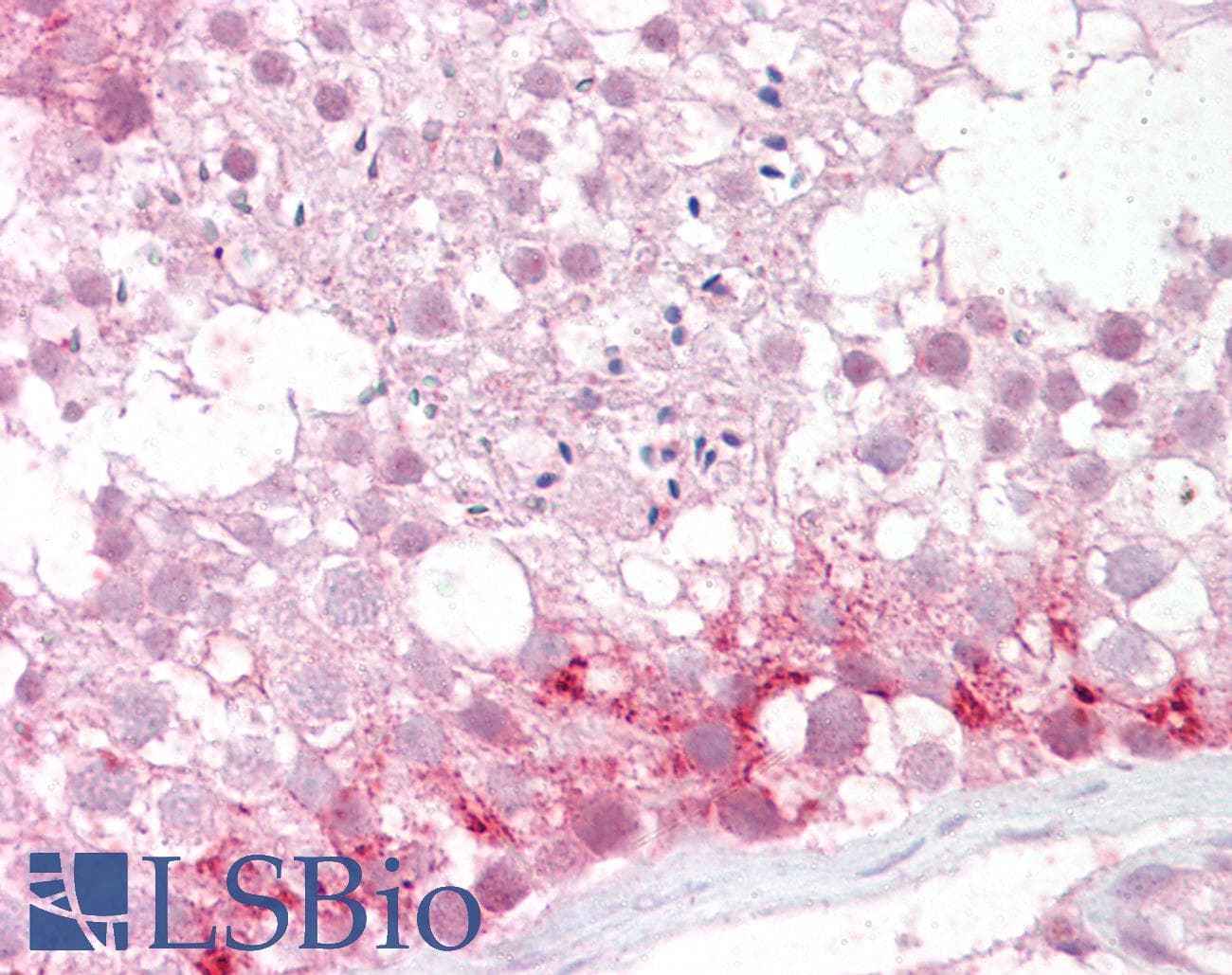 IHC-plus™ PMP70 Antibody (aa526-539)